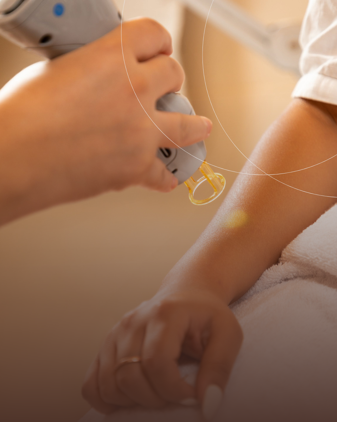 نصف الزراع (Half Arms)